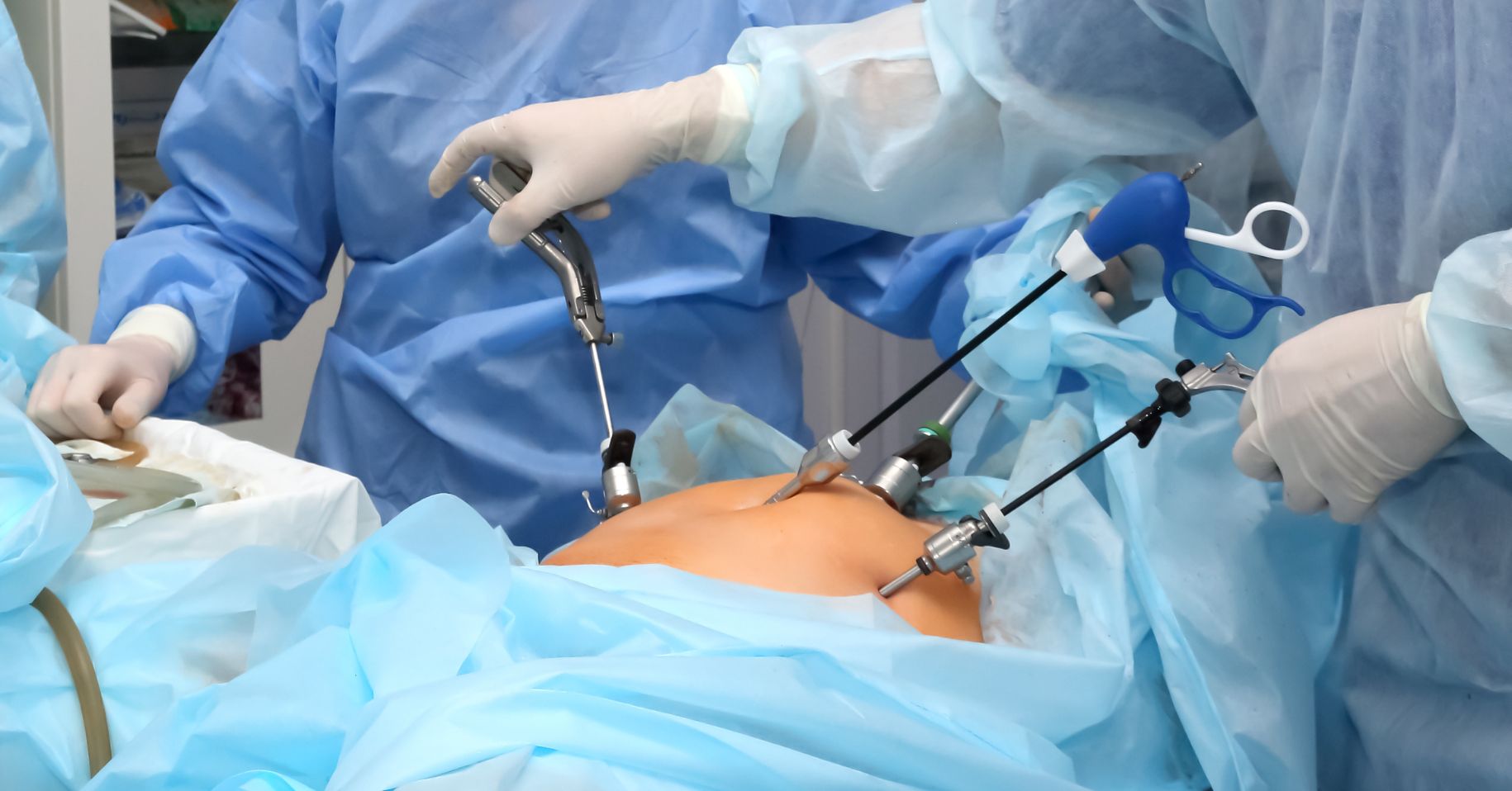 Gallbladder Surgery